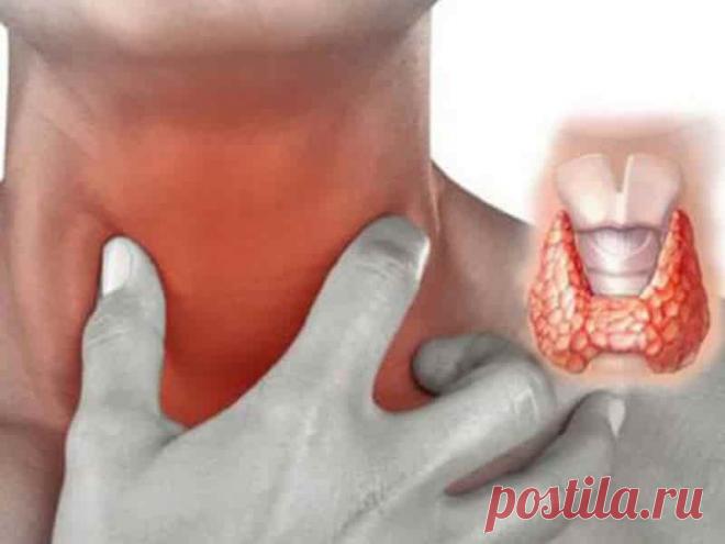 Простой (нетоксический) зоб  (код МКБ-10; код МКБ-11): описание, причины, симптомы, как лечить | Клиника лечения боли: врачи онлайн