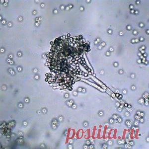 ЧТО НУЖНО ЗНАТЬ ГРИБКАХ В ОРГАНИЗМЕ...