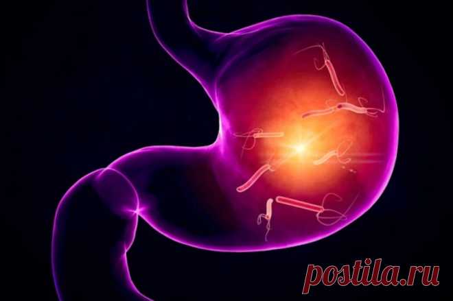 Как правильно сдавать анализы на хеликобактер Обнаружить бактерию хеликобактер (Helicobacter pylori), которая часото становится причиной гастрита, язвы и рака желудка, очень непросто, но все же возможно, рассказала терапевт и гастроэнтеролог Ольга Сухарева.