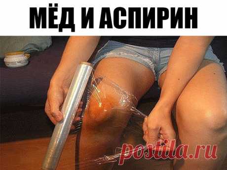 Подруга потратила две зарплаты, чтобы вылечить колени. Лишь это простое средство остановило артроз!

От различной степени болей в коленях и суставах страдает масса людей. Не чему удивляться, ведь колени подвергаются огромной нагрузке! Добавим сюда травмы во время занятий спортом, лишний вес, возрастные изменения хряща…
Мазь на основе мёда и аспирина способна остановить артроз. Ведь мёд — это природный биостимулятор, который способствует выработке суставной жидкости клеткам...