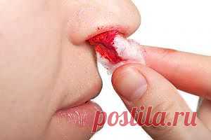 КРОВЬ ИЗ НОСУ НЕ НУЖНА | Друг пенсионера
У моей мамы не все в порядке с со­судами, да и давление повышено.