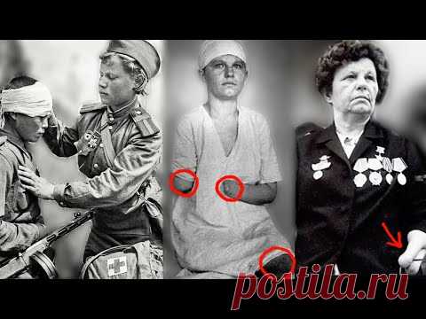 ЕЁ ИСКАЛЕЧИЛА ВОЙНА. ОНА ПОТЕРЯЛА РУКИ И НОГИ И НЕ НА СЕКУНДУ НЕ СДАЛАСЬ..