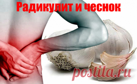 Радикулит. Чеснок, как лучший и быстрейший исцелитель от приступа радикулита.