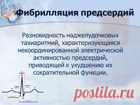 Катетерная абляция фибрилляции предсердий - что это такое, возможные осложнения