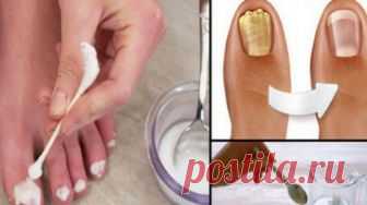 Я долго не могла удалить грибок с ногтя, пока я не сделала это. Результат меня очень порадовал Наши ногти являются частью наших рук, и ног, хотя они не имеют жизненно важного смысла, как сердце или другой орган, но они также необходимы.
Мы привыкли видеть их на наших рук.
Причина, которая влияе…