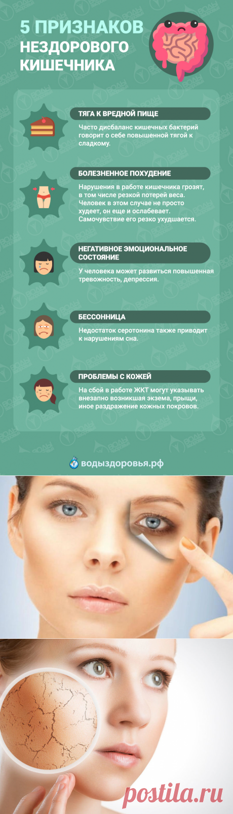 5 признаков нездорового кишечника