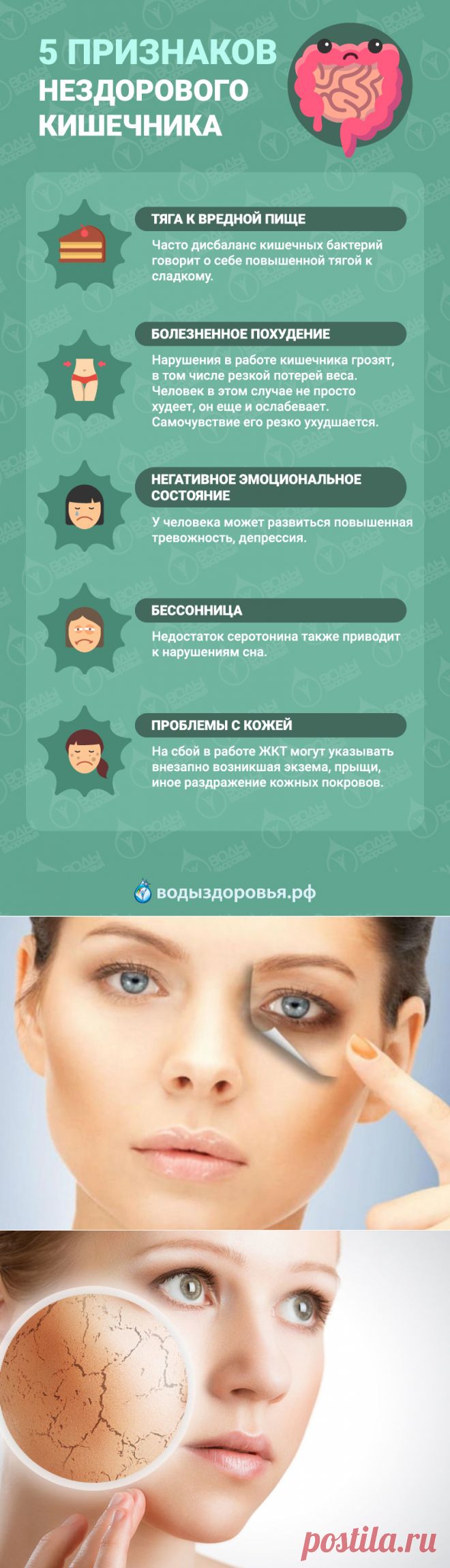 5 признаков нездорового кишечника