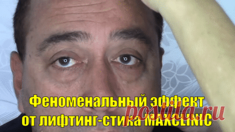 Девочки, это абсолютное новое средство в борьбе с морщинами и дряблостью  https://b.topmarketorder.ru/rd/l5olrJ   ! MAXCLINIC – три в одном: активная антивозрастная формула, массаж лица и акупунктура! Борется со старением по всем фронтам, обеспечивая быстрый эффект . Один стик MAXCLINIC содержит 4 вида коллегана, витамины, пептиды, яд паука и еще много ценных компонентов . День за днем он укрепляет и подтягивает кожу, делает морщины менее заметными, улучшает циркуляцию крови и питает колл