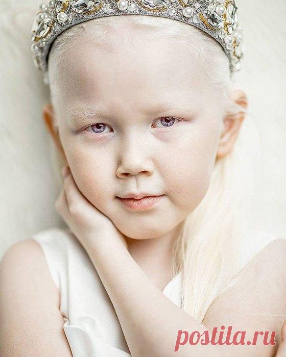 Белоснежка из Якутии: 8-летняя девочка-альбинос покорила Интернет