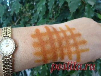 Йодовая сетка: целебные свойства простых линий