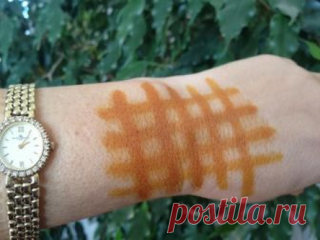Йодовая сетка: целебные свойства простых линий