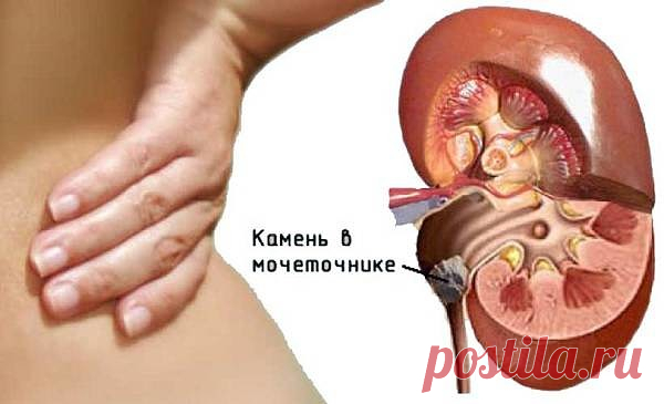 ПОЛЕЗНЫЕ СОВЕТЫ ДЛЯ ОЧИЩЕНИЯ ПОЧЕК 

ПОЛЕЗНЫЕ СОВЕТЫ ДЛЯ ОЧИЩЕНИЯ ПОЧЕК
 







Почки. Свекольный тест. Съешьте 400 грамм свеклы вечером и посмотрите какого цвета будет моча утром. Если моча окрашивается, у вас снижена функция почек. …