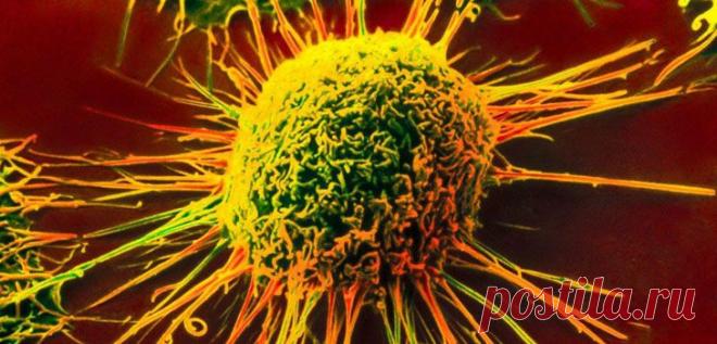 Какой вид рака самый опасный.... | Познавательный сайт ,,1000 мелочей"