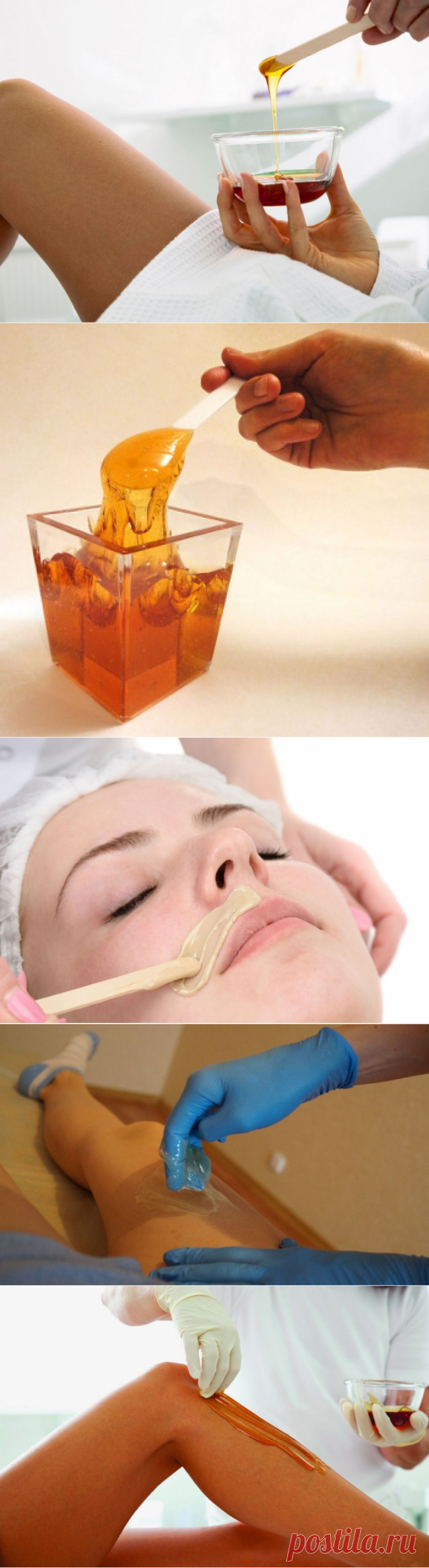 Сахарная эпиляция: фото и видео