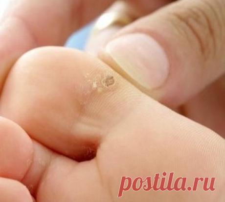 (18) Одноклассники