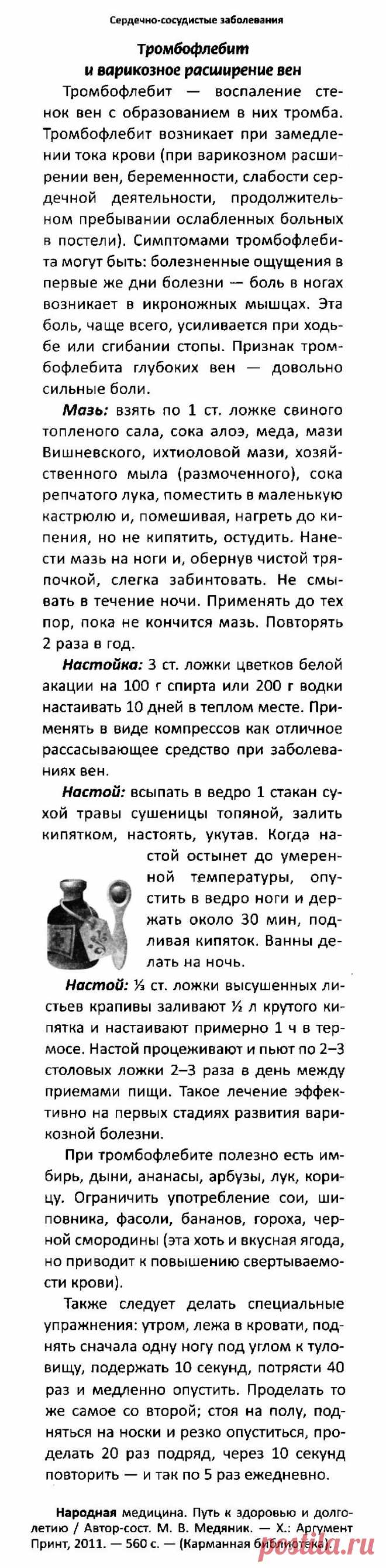 Тромбофлебит и варикозное расширение вен