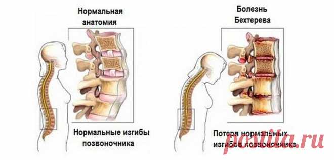 Боль в тазобедренном суставе: причины, лечение, что делать и как лечить