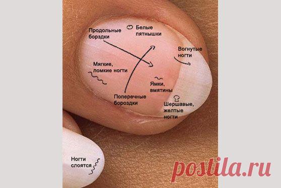 Обратим внимание на ногти....