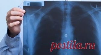 Как распознать скрытое воспаление легких | Журнал Домашний очаг