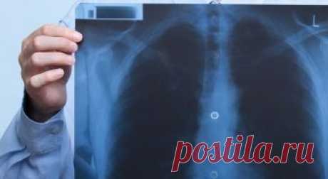 Как распознать скрытое воспаление легких | Журнал Домашний очаг