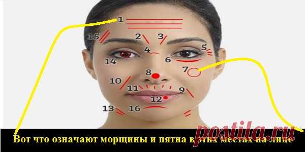Вот что означают морщины и пятна в этих местах на лице!  Уже бегу за зеркалом.