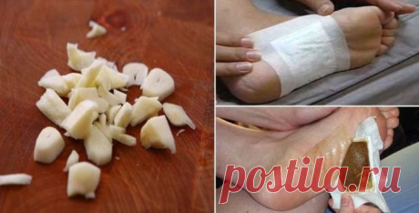 Это мощнейшая детоксикация всего организма во время сна… Даже мой врач не удержался и взял рецепт! Это очень простой, но невероятно эффективный метод для вывода токсинов из организма. Вывод токсинов происходит через кожу стоп во время сна. Это своего рода компресс, который закрепляется на подошвах ног и находиться в таком положении на протяжении сна. Сила здоровья и красоты в натуральных рецептах!  Из-за загрязненной окружающей среды, неправильного питания, химических лека...