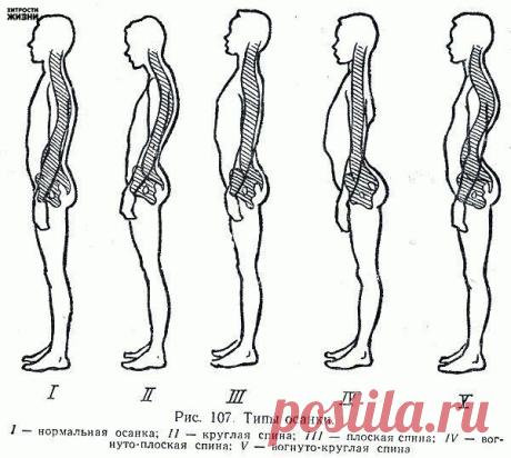 ДЕЛАЕМ СПИНУ ПРЯМОЙ И КРАСИВОЙ! » Смешные Анекдоты Истории Цитаты Афоризмы Стишки Картинки прикольные Игры