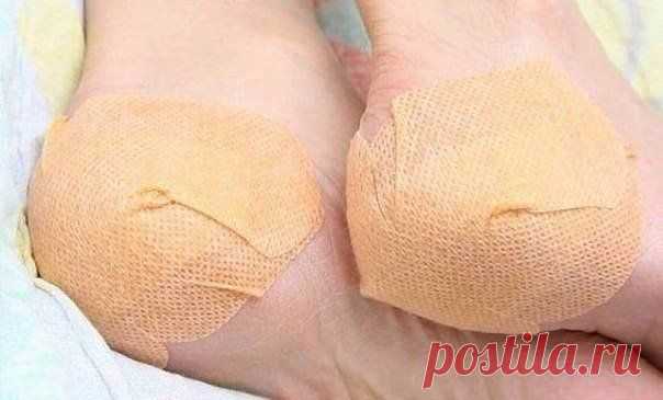 Простой и очень эффективный крем для нежных пяточек