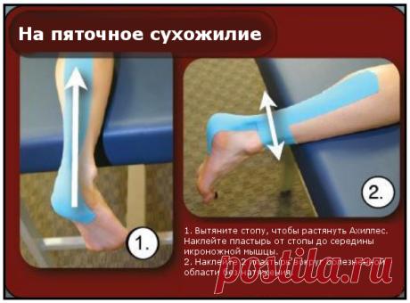 Кинезио тейп: инструкция, цена, виды пластыря, где купить?
