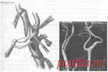 ХАРЬКОВСКАЯ КЛИНИЧЕСКАЯ БОЛЬНИЦА НА ЖЕЛЕЗНОДОРОЖНОМ ТРАНСПОРТЕ - ХОЛЕСТЕРИН И ЛИПИДЫ
