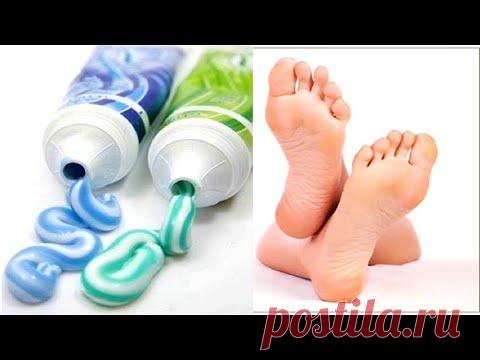 Просто Намажь ПЯТКИ зубной пастой! Эффект УДИВИТ!!!