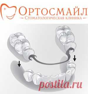 Стоматология Ортосмайл - съемное протезирование зубов