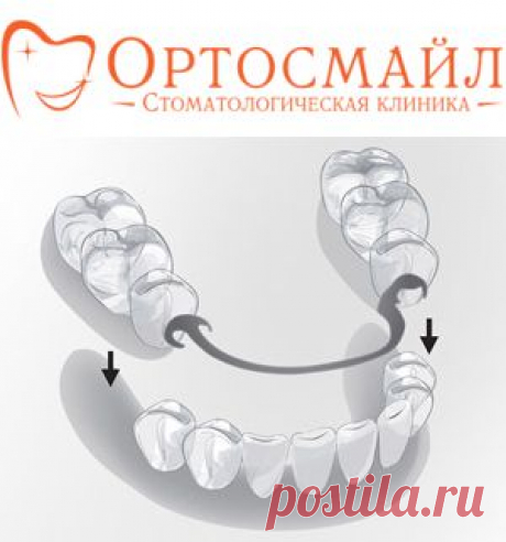 Стоматология Ортосмайл - съемное протезирование зубов