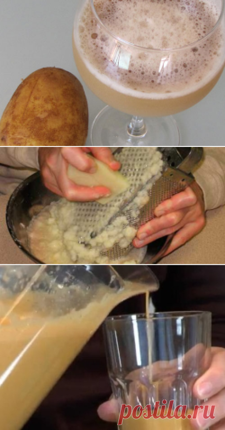 Картофельный сок при гастрите