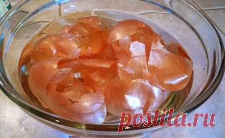 Варикоз и сосудистые "звездочки" на ногах - простое решение проблемы.
Поможет лук! 3 лучших рецепта