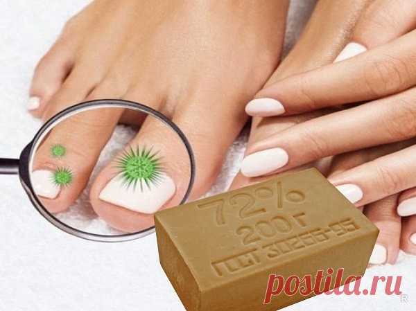 Польза хозяйственного мыла для лечения инфекционных заболеваний, в косметологии