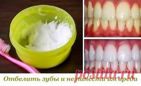 Отбелить зубы и не нанести им вреда. 
 
Данный метод помогает практически при любых заболеваниях десен и при этом почти моментально отбеливает зубы, растворяет камень и залечивает маленькие ранки во рту. 
 
Ингредиенты: 
- 0,5 ч.л. питьевой соды добавить 
- 10-20 капель перекиси водорода (аптечной) 
- несколько капель лимона. 
 
В соду добавить перекись водорода и сок лимона. Паста готова! 
 
Ватку обмакиваем в пасту и натираем пастой зубы и десны снаружи и изнутри. 
 
Лим...