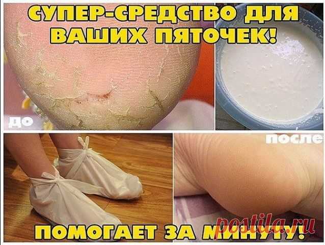 Берём небольшую мисочку (такого размера, чтобы только поместились в неё ноги), наливаем 1,5 литра воды , чтобы была горяченькая, но не очень. Добавляем в воду 4 столовых ложки перекиси водорода. Ставим ноги в воду и сидим.После этого втираем смесь глицерина с уксусом (купила в аптеке бутылочку глицерина и добавила до полной обычный столовый уксус). Ежедневно. А ванночки с перекисью - один раз в неделю.