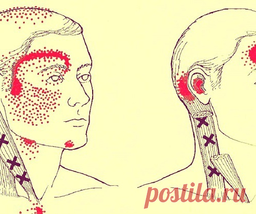НЕХВАТКА ВСЕГО 4 ПРОДУКТОВ ПРОВОЦИРУЕТ ГОЛОВНУЮ БОЛЬ