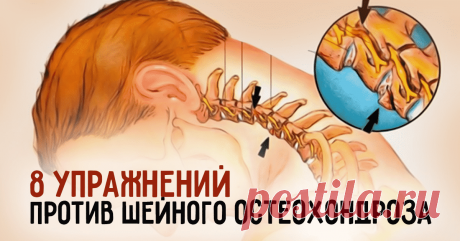 8 упражнений против шейного остеохондроза Первые проявления шейного остеохондроза - боли в спине, головные боли, головокружение, “мушки” в глазах, ухудшение слуха или шумы, а также покачивание при ходьбе в результате нарушения координации.