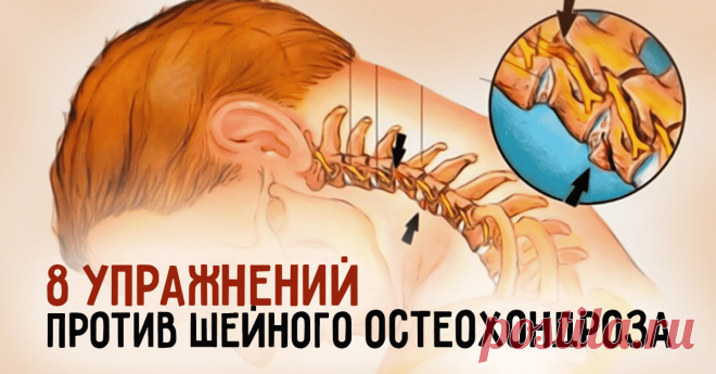 8 упражнений против шейного остеохондроза Первые проявления шейного остеохондроза - боли в спине, головные боли, головокружение, “мушки” в глазах, ухудшение слуха или шумы, а также покачивание при ходьбе в результате нарушения координации.