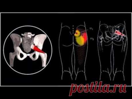СИНДРОМ ГРУШЕВИДНОЙ МЫШЦЫ И ЗАЩЕМЛЕНИЕ СЕДАЛИЩНОГО НЕРВА ⭐ SLAVYOGA