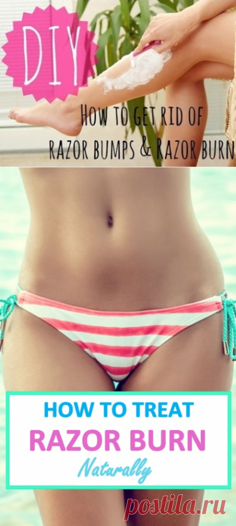 How to Get Rid of Razor Burn Fast | Virtual Clinic