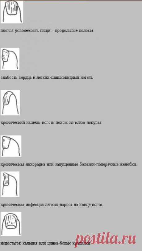 Диагностика по ногтям в восточной медицине | ВСЕГДА В ФОРМЕ!