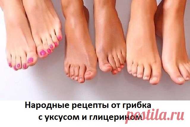 Глицерин с уксусом от грибка Эффективно применяется глицерин с уксусом от грибка. Народные рецепты приготовления и как применять глицерин с уксусом от грибка ногтей.