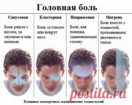 Самый полный гид по головной боли - Полезно Знать