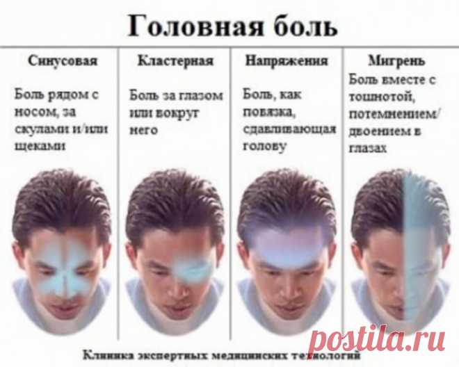 Самый полный гид по головной боли - Полезно Знать