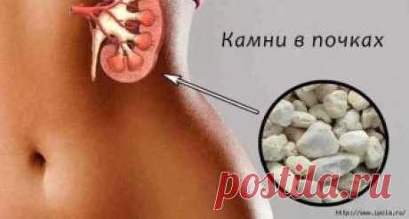Поделюсь рецептом растворения камней в почках, который неоднократно проверен на родственниках и знакомых! Поделюсь рецептом растворения камней в почках, который неоднократно проверен на родственниках и знакомых. Понадобится 500 г моркови и 500 г изюма без косточек. Морковь почистить, нарезать кубиками, изюм...