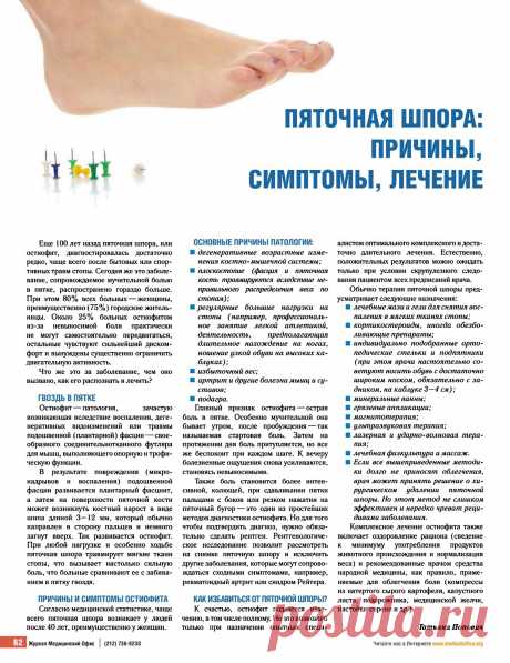 Пяточная шпора: причины, симптомы, лечение