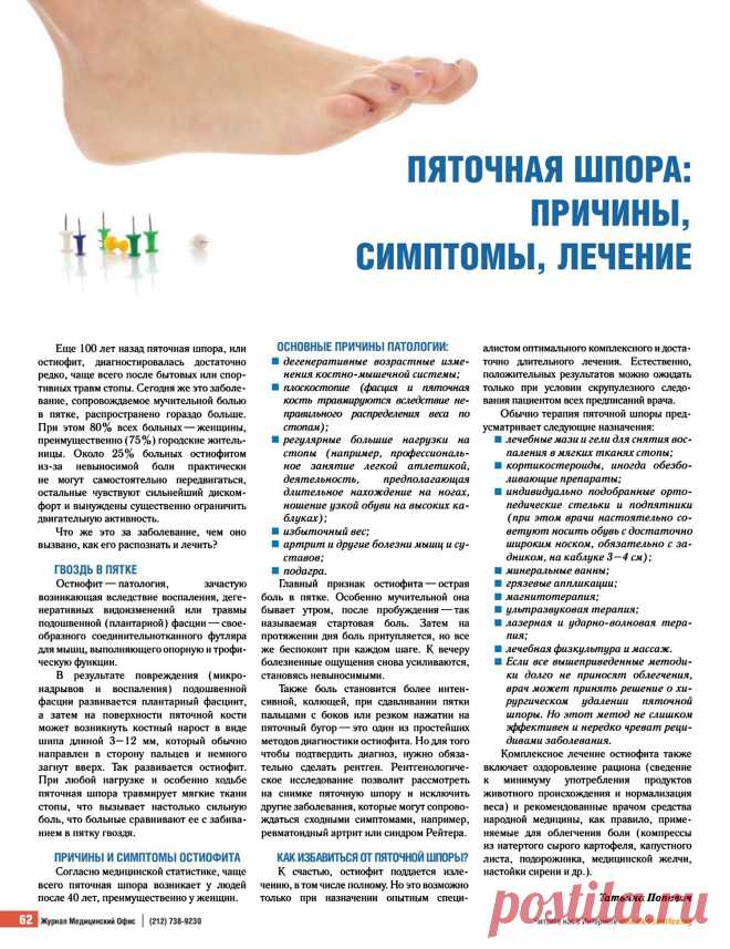 Пяточная шпора: причины, симптомы, лечение